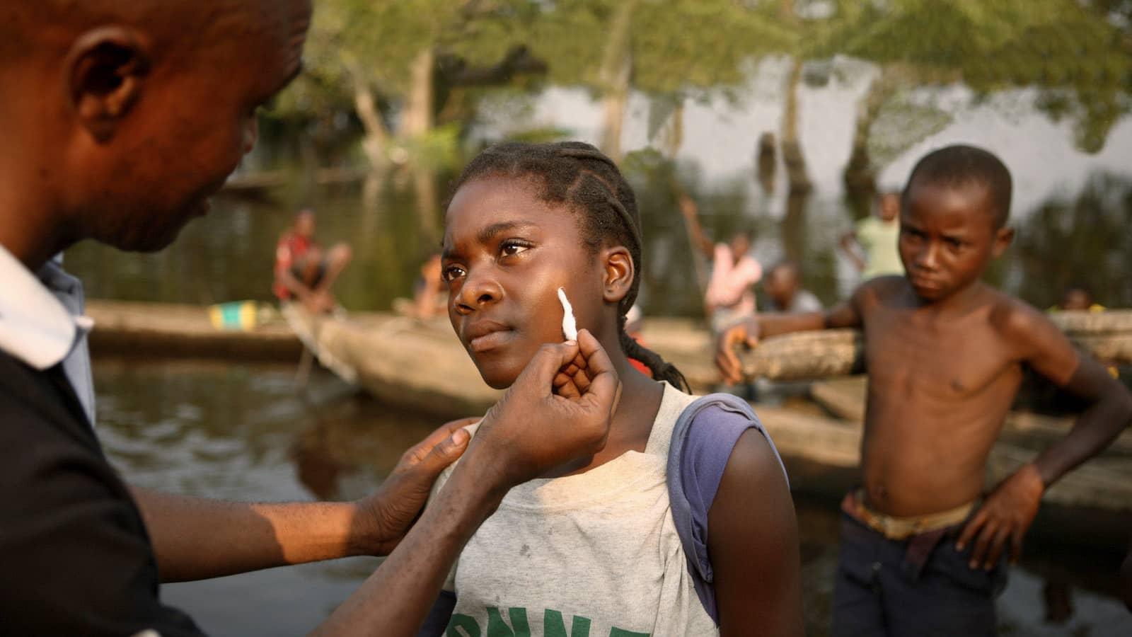 世界麻风病日：1 月 30 日